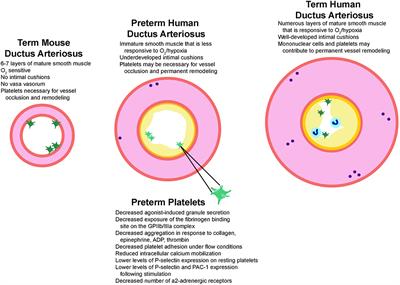 Current Controversy on Platelets and Patent Ductus Arteriosus Closure in Preterm Infants